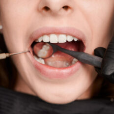 Dental Exams & Cleanings Image