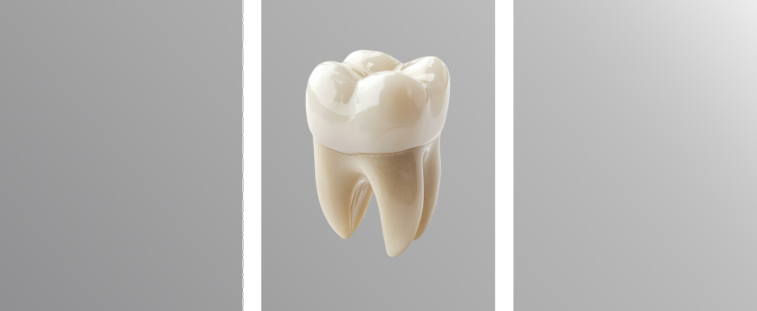 Dental Crowns