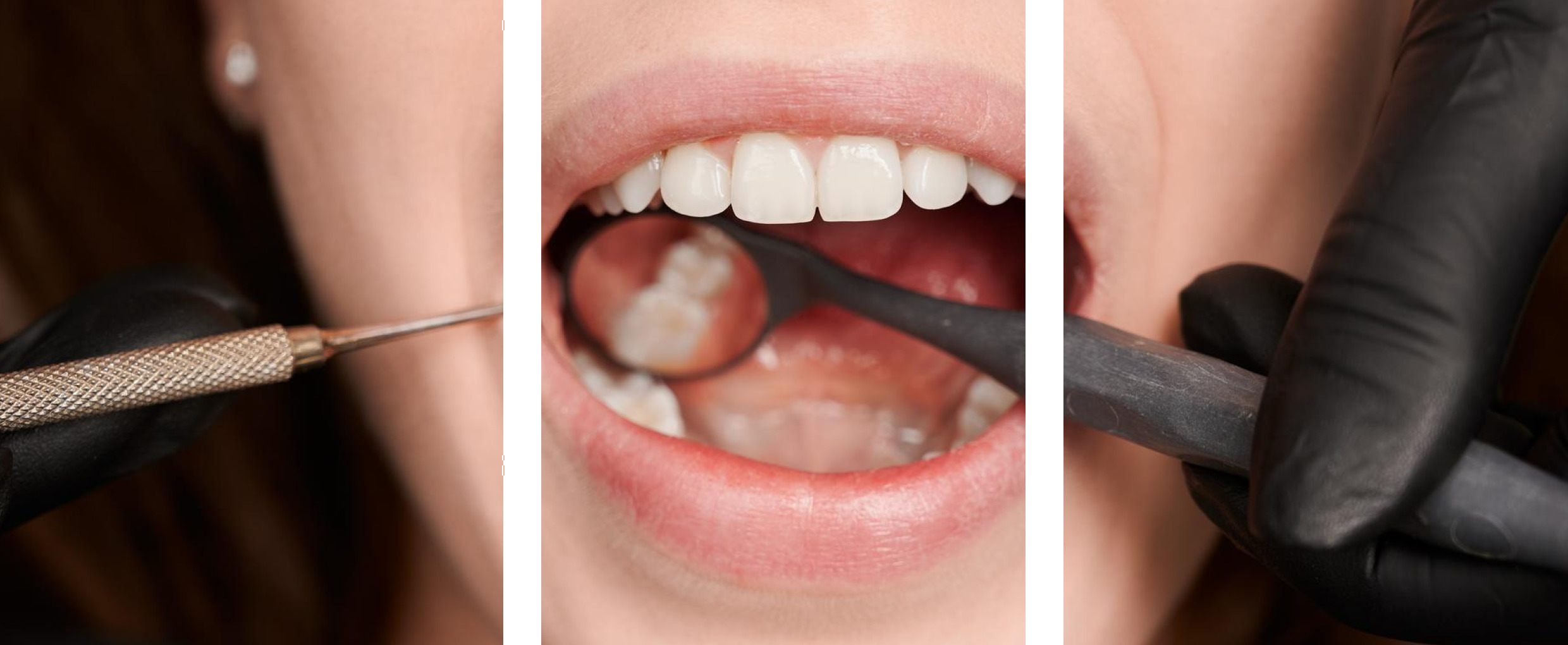 Dental Exam & Cleanings