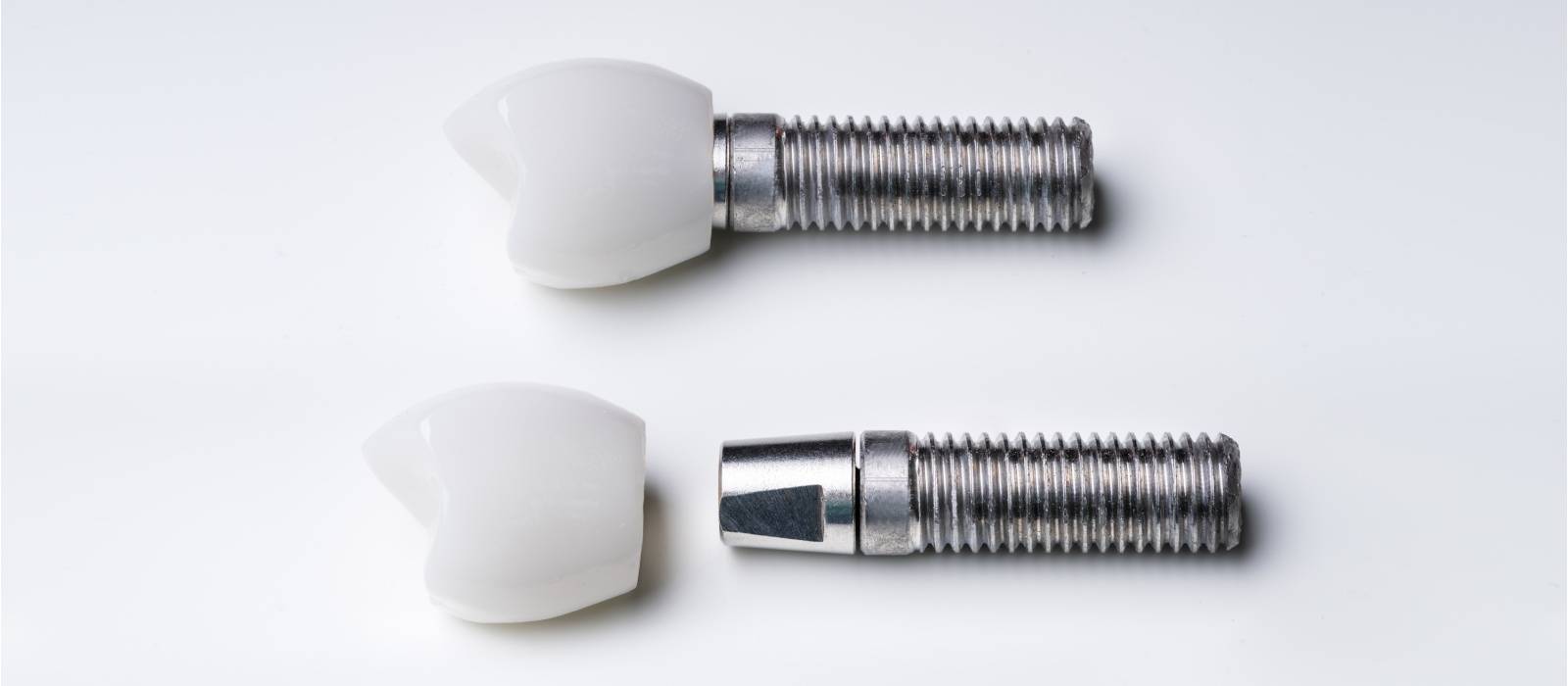 Dental Implants Image
